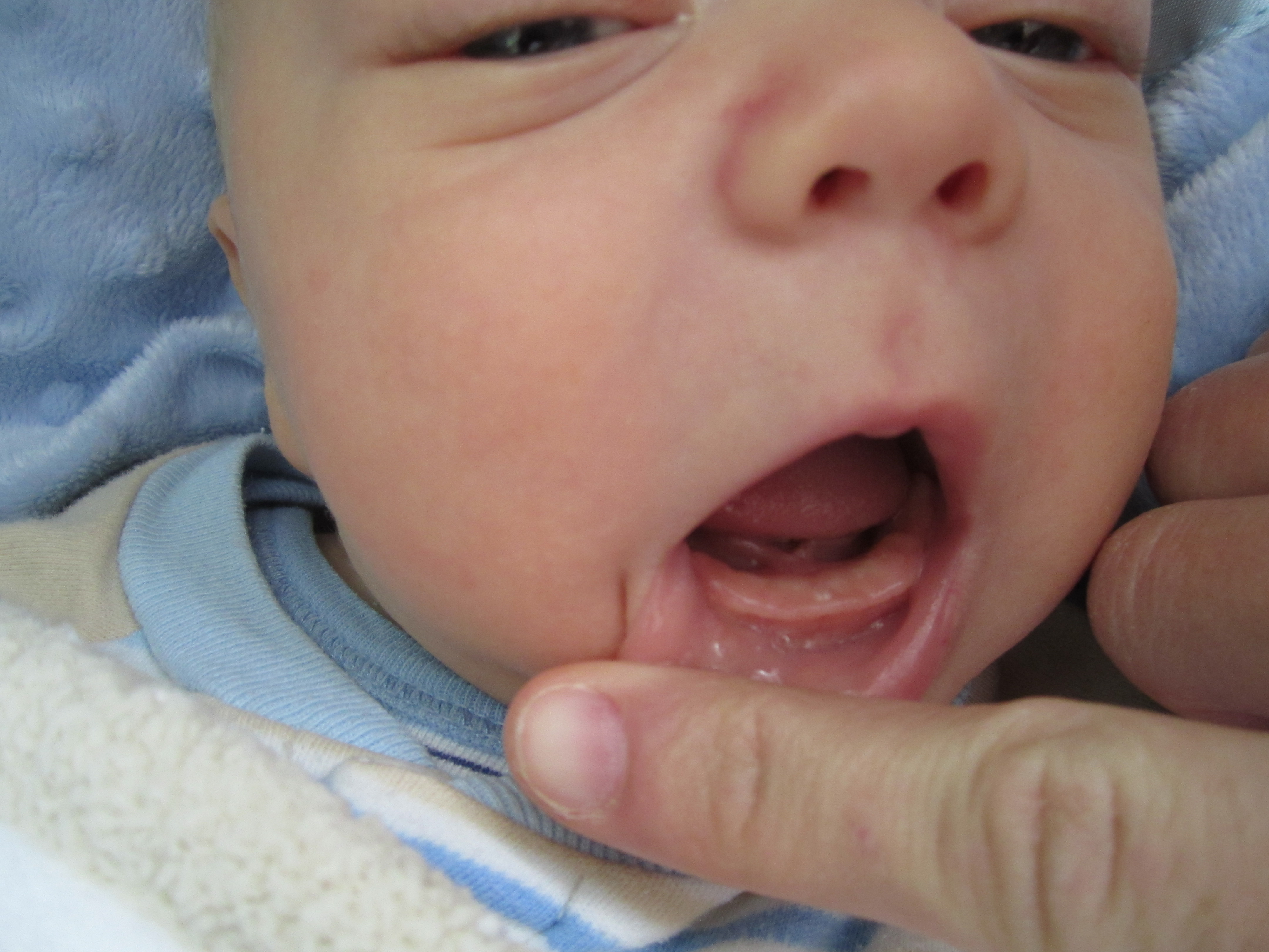первые зубы ребенка фото